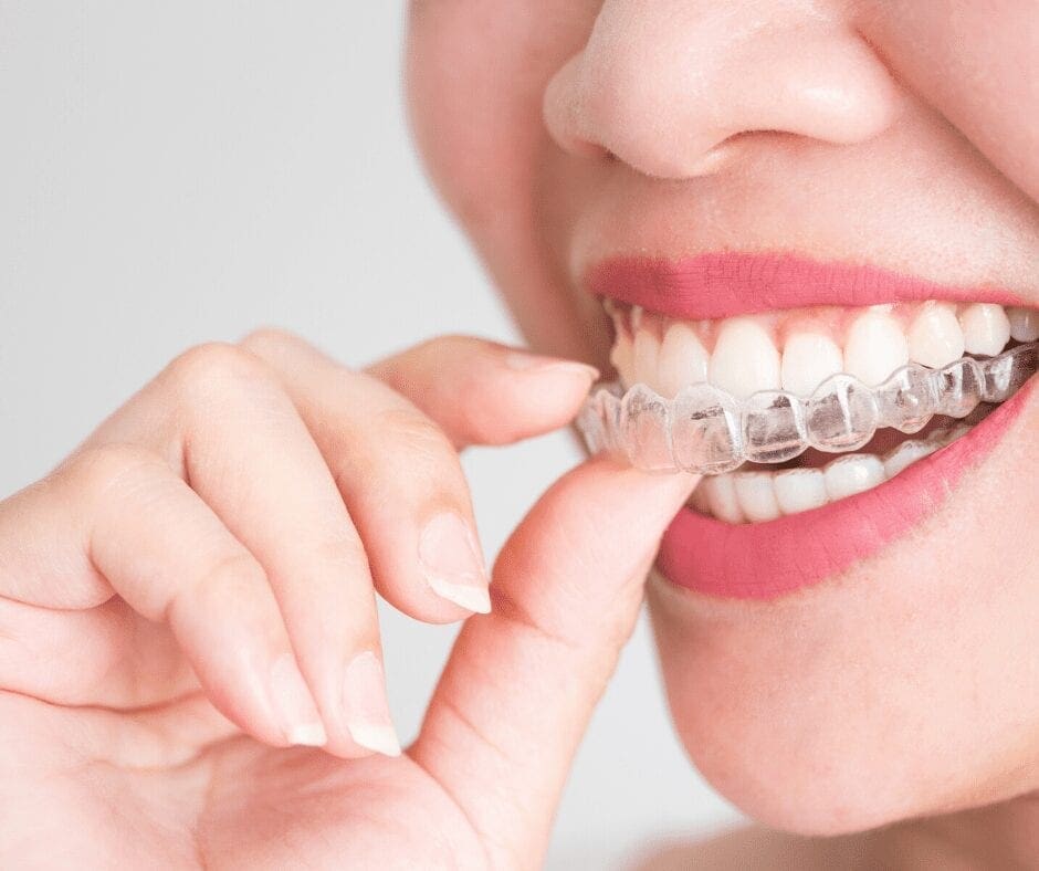 Woman smiling with Invisalign Treatment