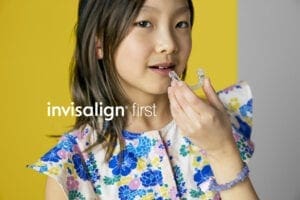 invisalign first