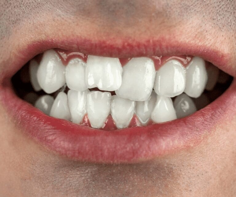 orthodontics tacoma