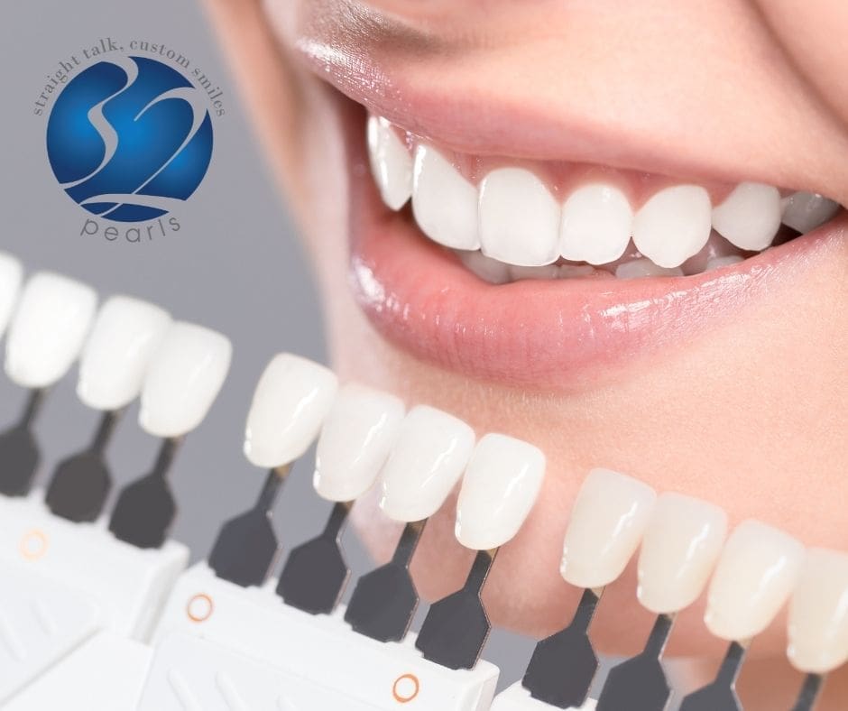 Tacoma teeth whitening