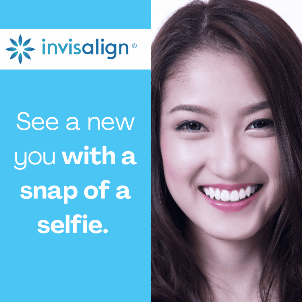 SmileView Invisalign 