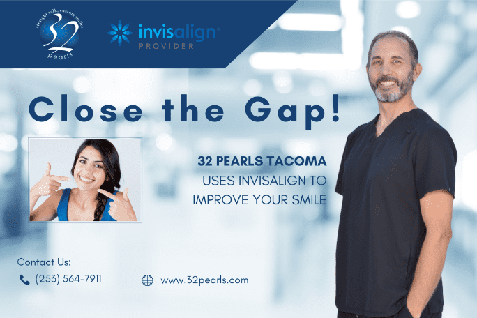 Invisalign for Gaps