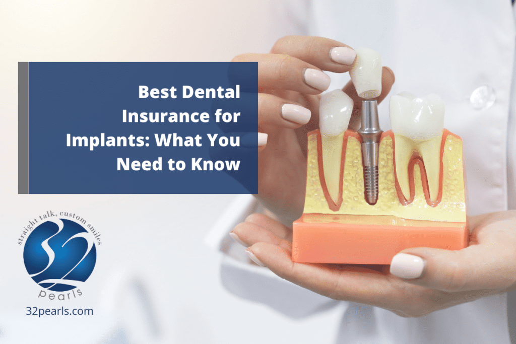Best Dental Insurance for Implants: What You Need to Know