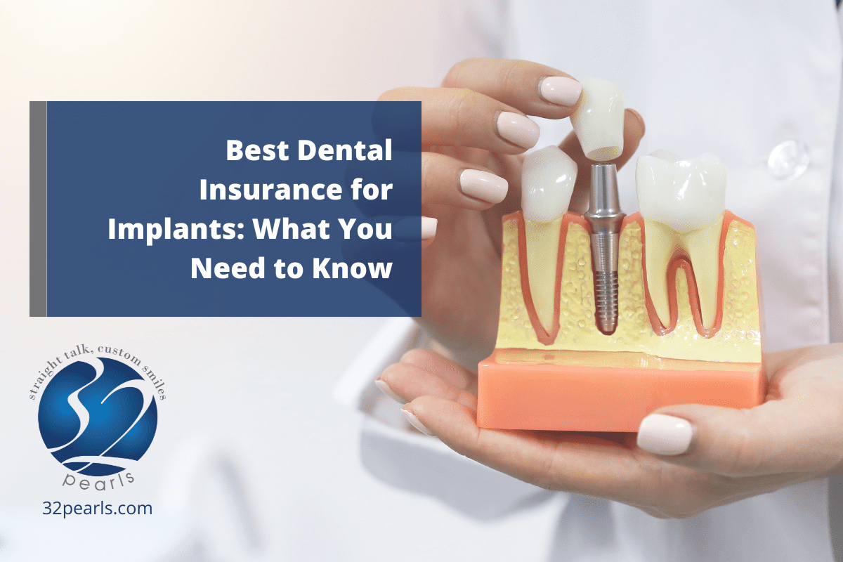 Best Dental Insurance for Implants: What You Need to Know
