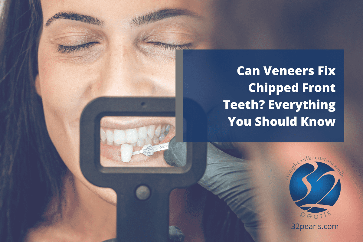 Can Veneers Fix Chipped Front Teeth? Everything You Should Know