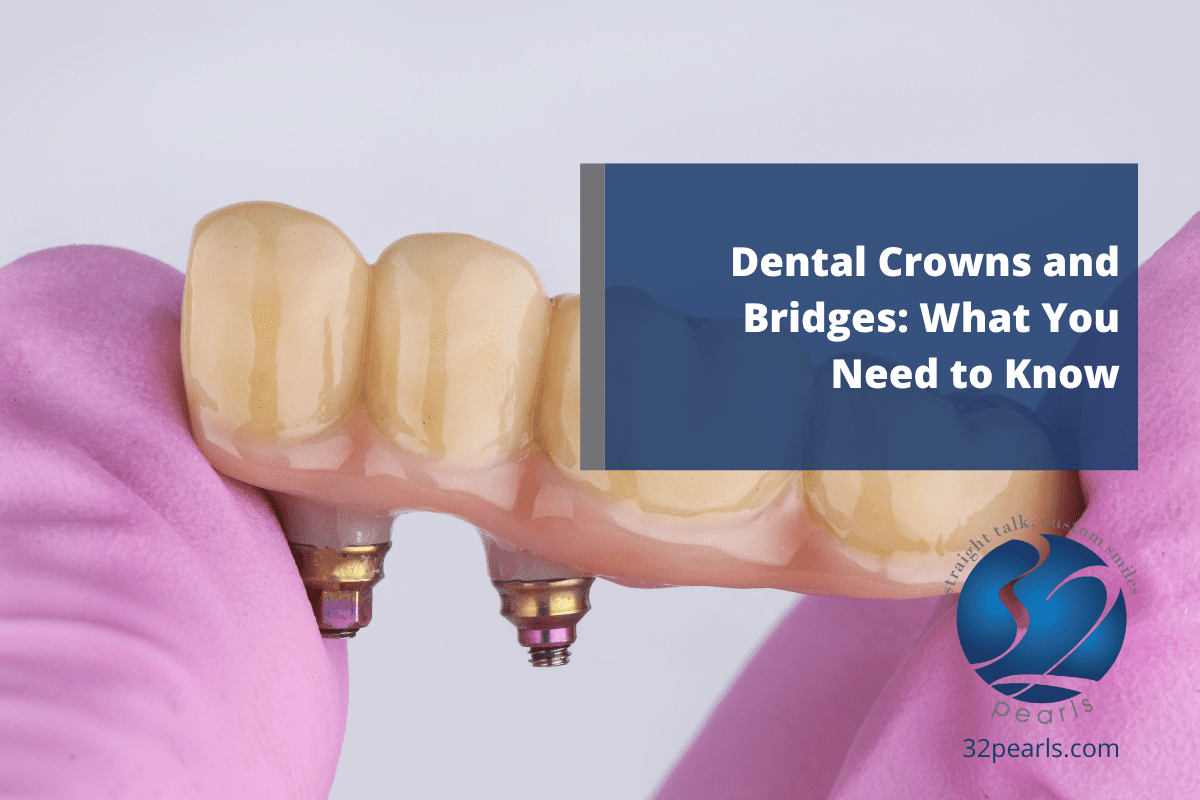 Dental Crowns and Bridges: What You Need to Know