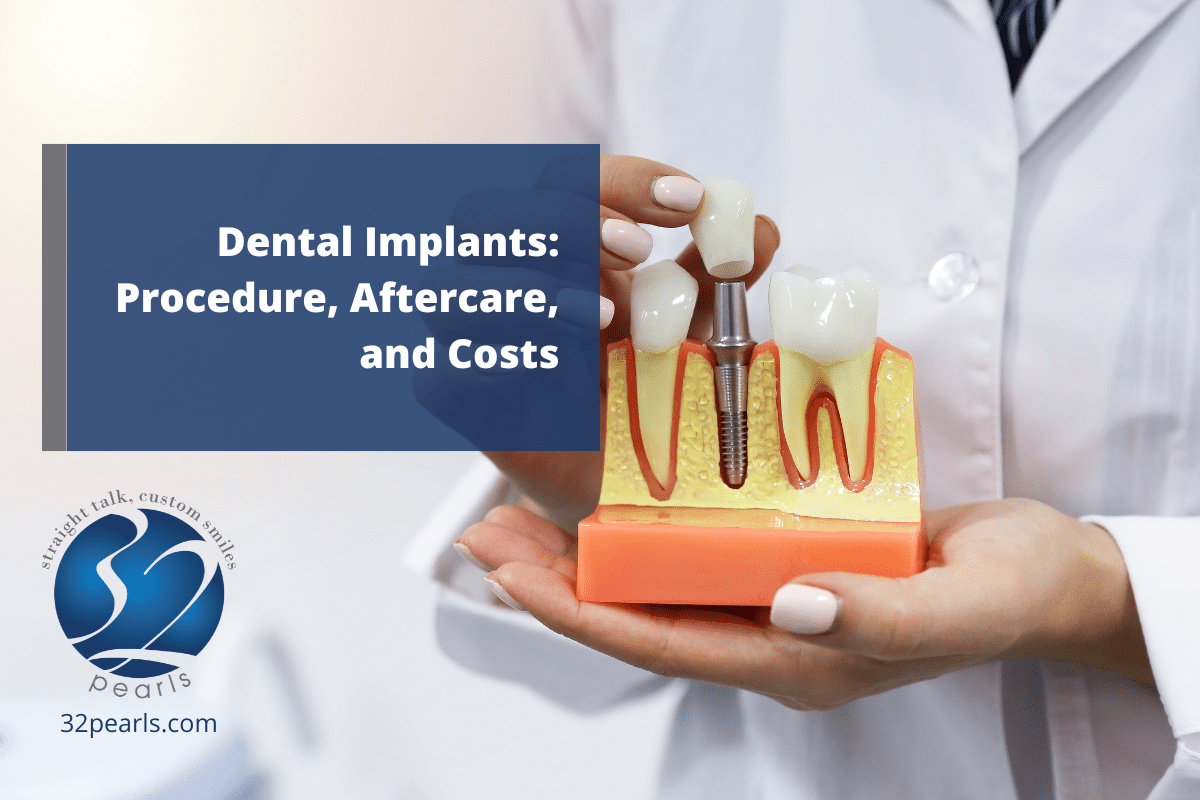 Dental Implants: Procedure, Aftercare, and Costs